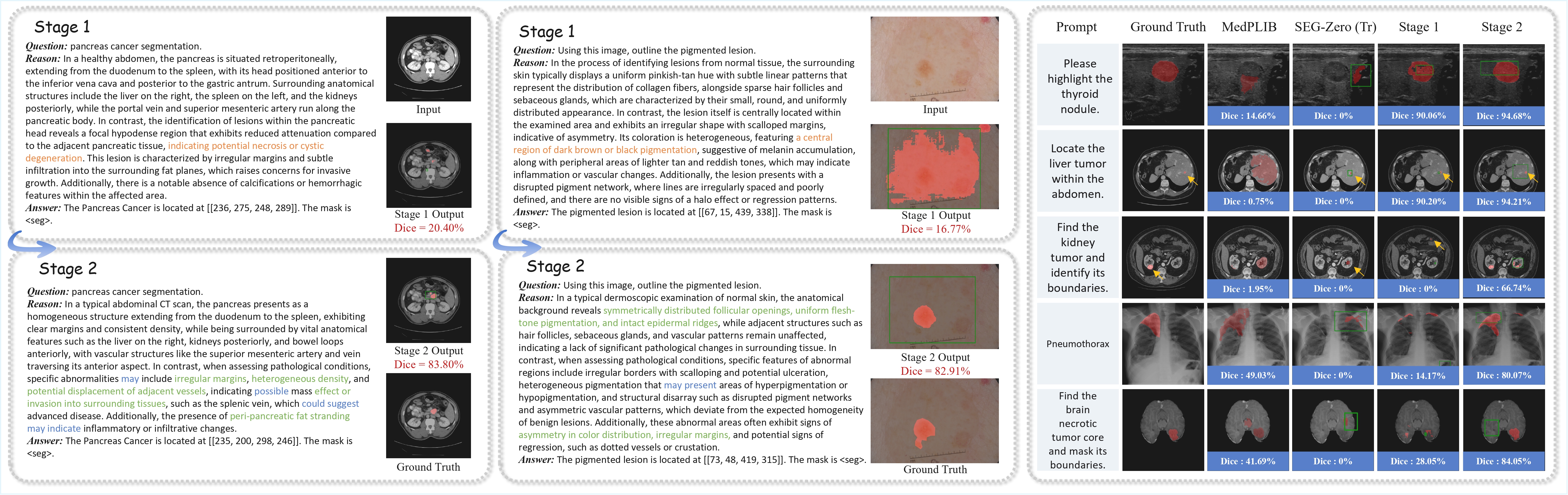 CORE-Seg experiment results: qualitative comparison